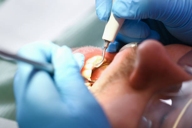 Best Tooth Infection Emergency Dentist  in Anaconda, MT