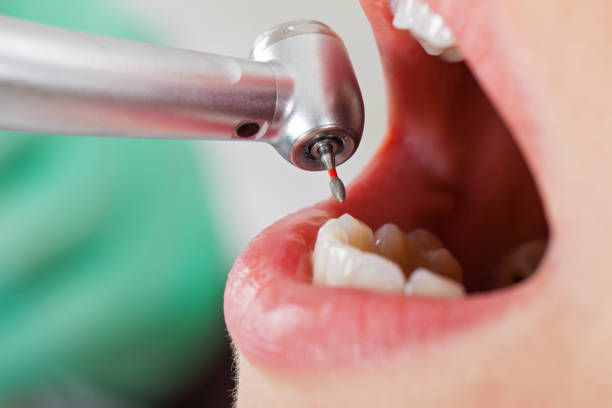 Best Cracked Tooth Emergency Dentist  in Anaconda, MT